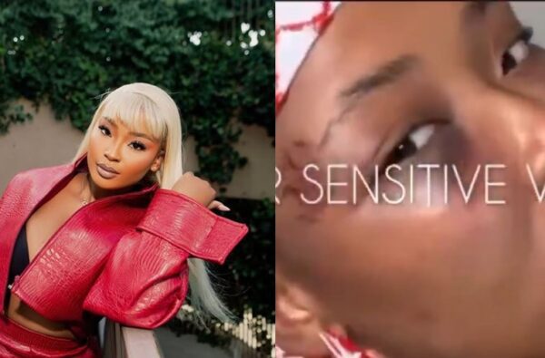 Cyan Boujee reveals bruised face, alleges abuse by boyfriend (Video)